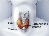 Изменения щитовидной железы